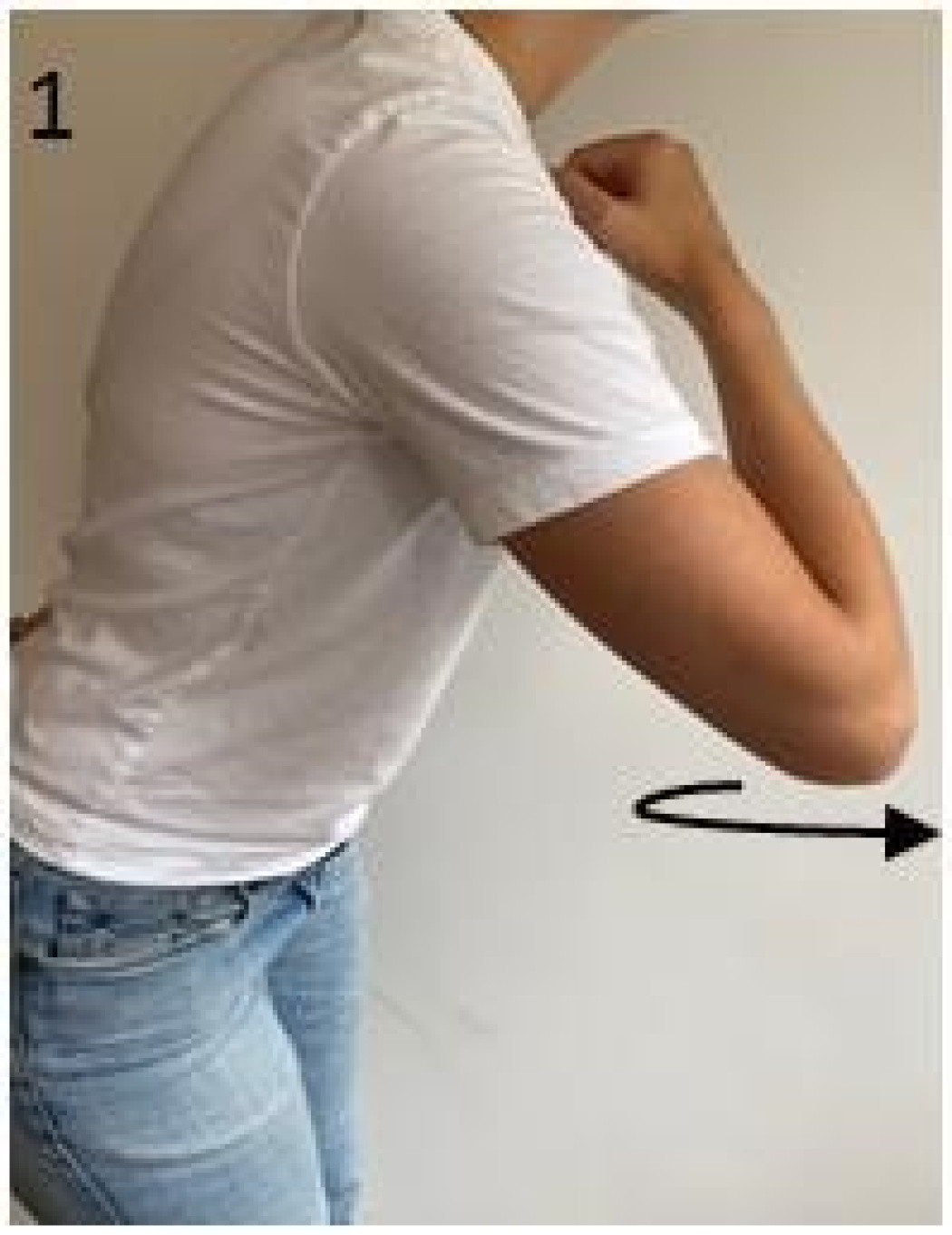 Dislocated collarbone St. Antonius Ziekenhuis