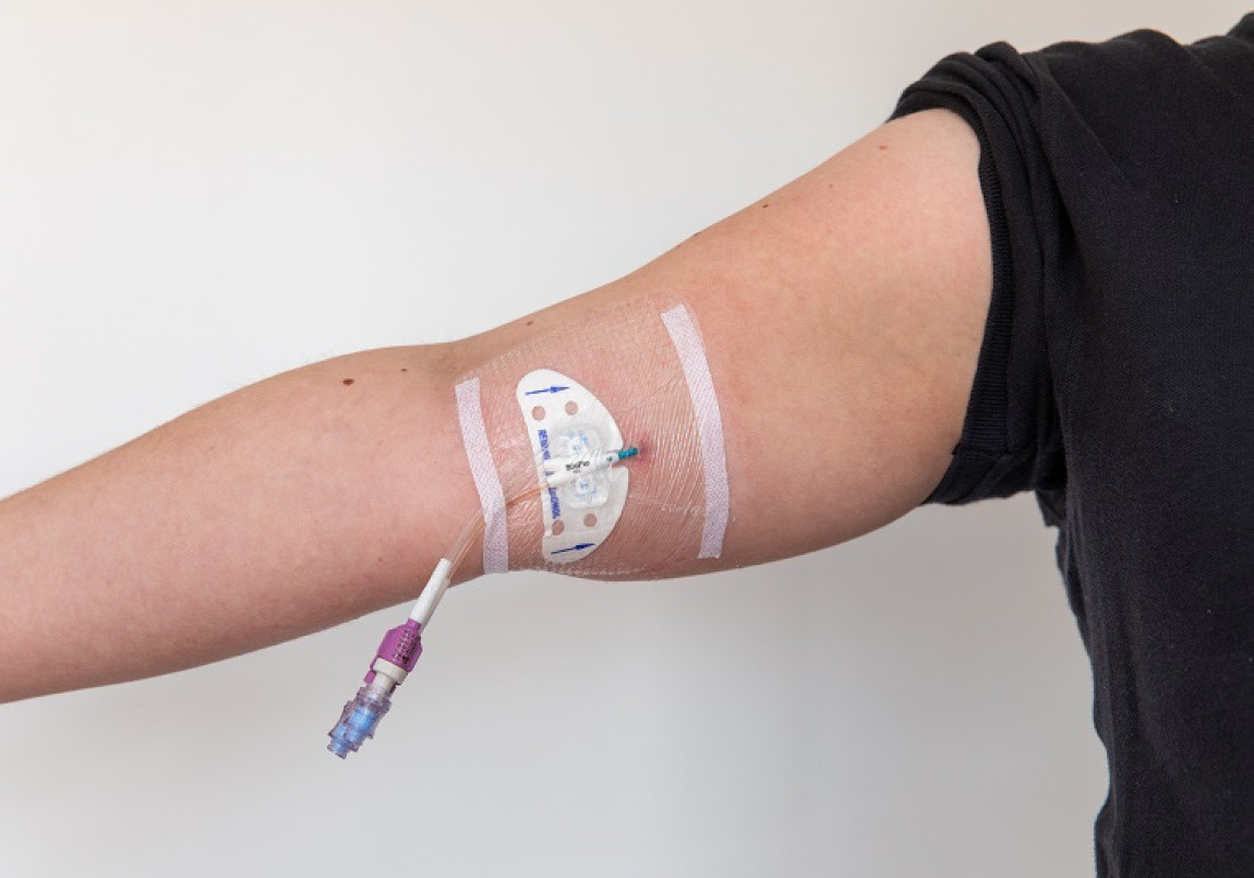 De Perifeer Ingebrachte Centrale Catheter (PICC) | St. Antonius Ziekenhuis