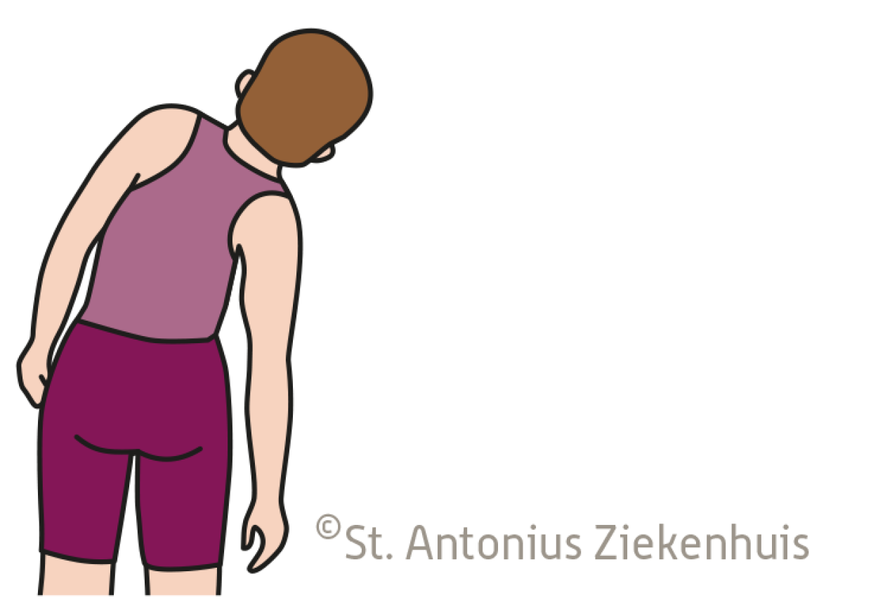 Schouder uit de kom (schouderluxatie) | St. Antonius Ziekenhuis