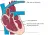 De elektrodes in het hart