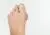 Een photo van hallux valgus