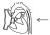 Illustratie van een Langwerpige ballon in de aorta, voordat deze is opgeblazen.
