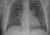 Longfoto