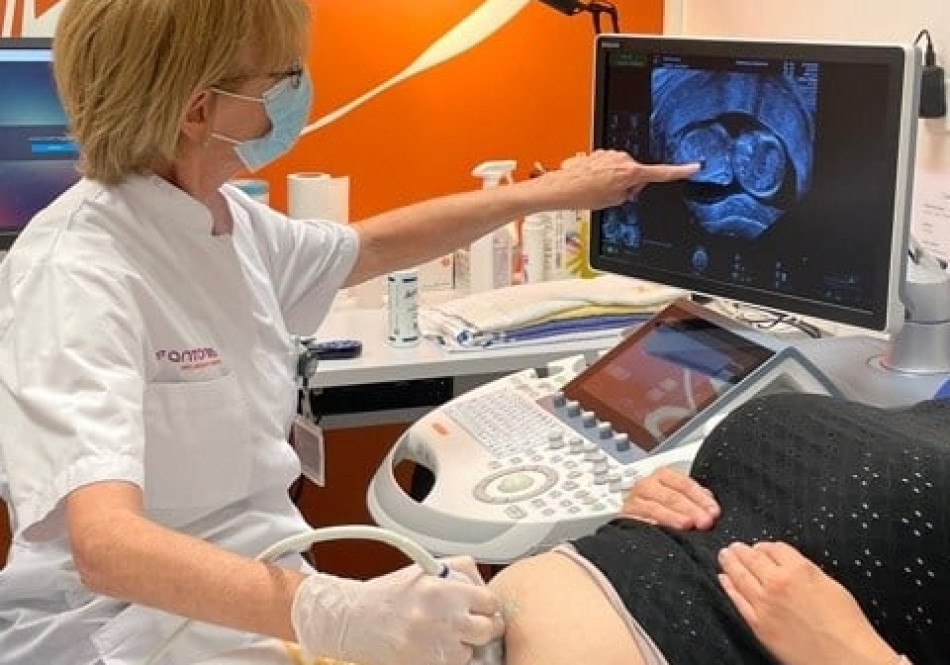 Echoscopie tijdens de zwangerschap | St. Antonius Ziekenhuis
