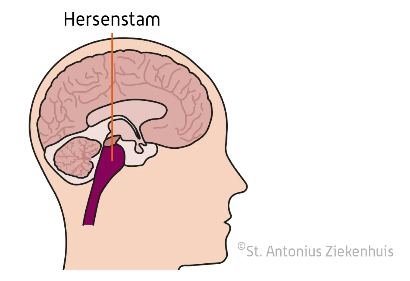 Hersenstam