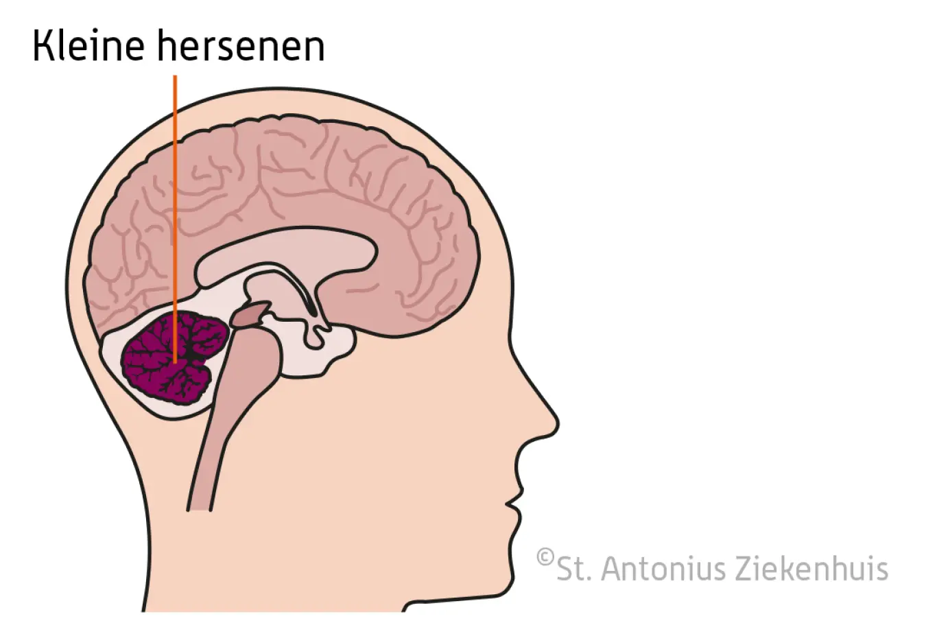 kleine hersenen