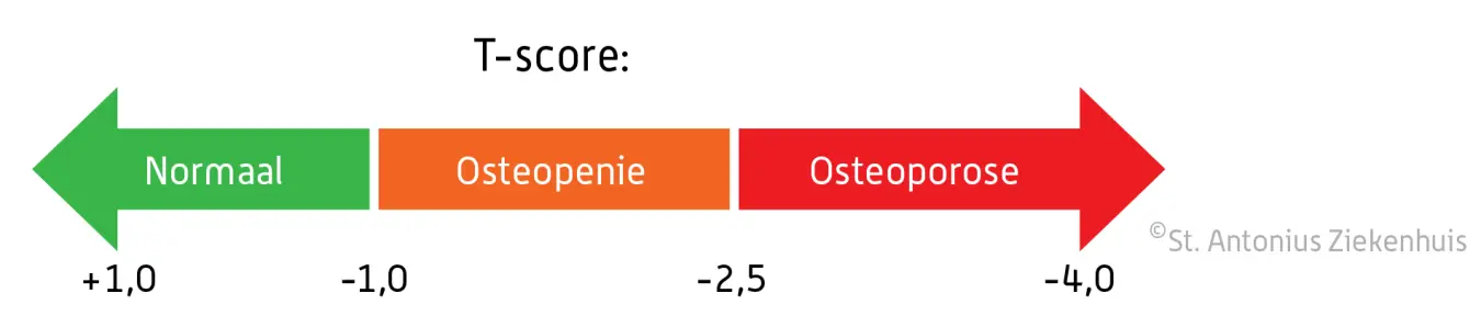 T-score