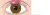voorbeeld chalazion