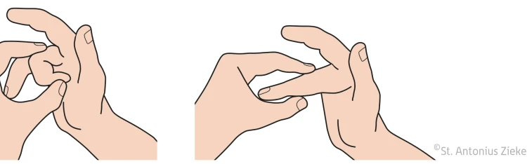 Grafische weergave van oefening door met de andere hand de vingers van de aangedane hand zo ver mogelijk te buigen en te strekken