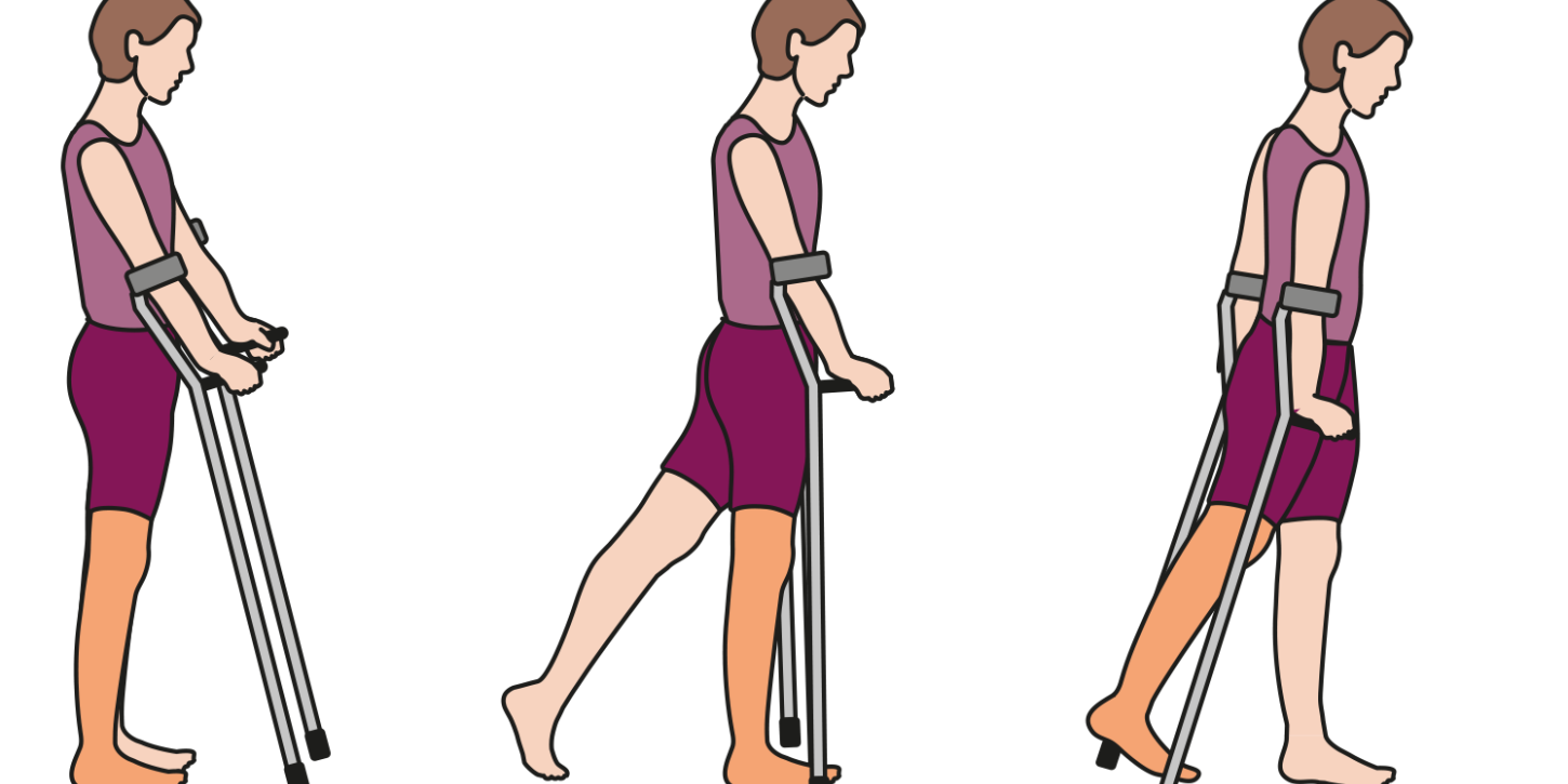 Fysiotherapie na een knieprothese St. Antonius Ziekenhuis