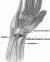 anatomische tekening van de zenuw die bekneld raakt in de pols bij carpale tunnelsyndroom