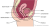 Afbeelding van het zijaanzicht van de vrouwelijke bekkenbodem en urinewegen