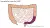 LAR-operatie (Low Anterior Resectie)