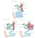 redo gastric bypass